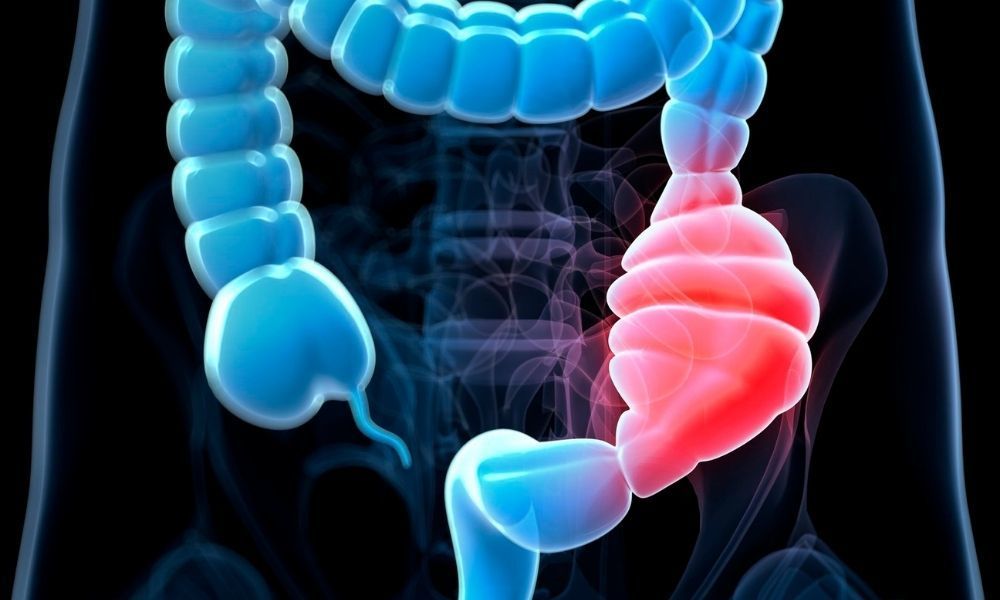 KANSER CERRAHİSİNDE ROBOTİKLE HIZLI İYİLEŞME