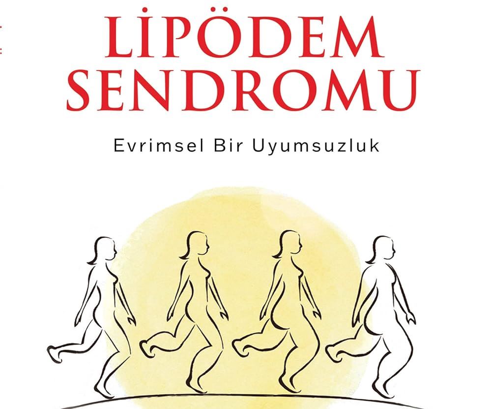 Kilo Veremiyorsanız Suçlu İradeniz Değil, Lipödem Olabilir