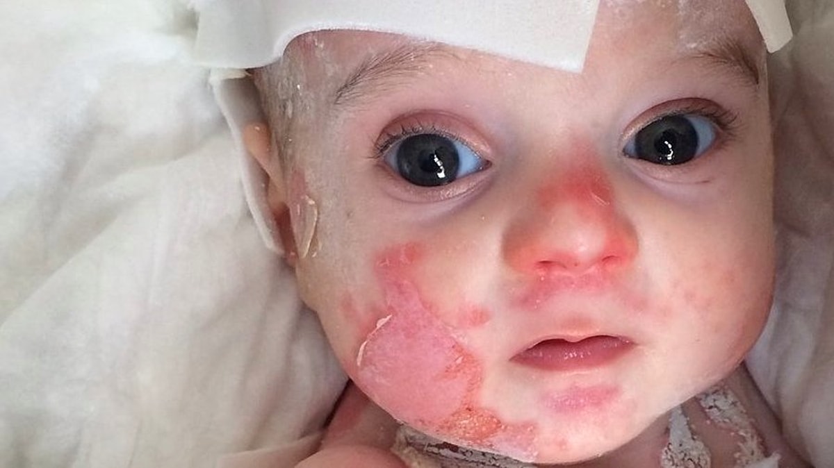 Bu Hastalık Kadınlarda 9 Kat Fazla Görülüyor